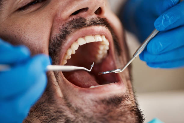 Best Emergency Cosmetic Dentistry (e.g., broken veneers) in Yates Center, KS